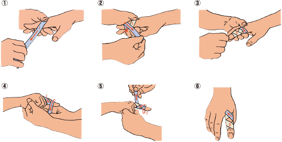 突き指 テーピング 指
