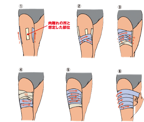 方 巻き ふくらはぎ テーピング